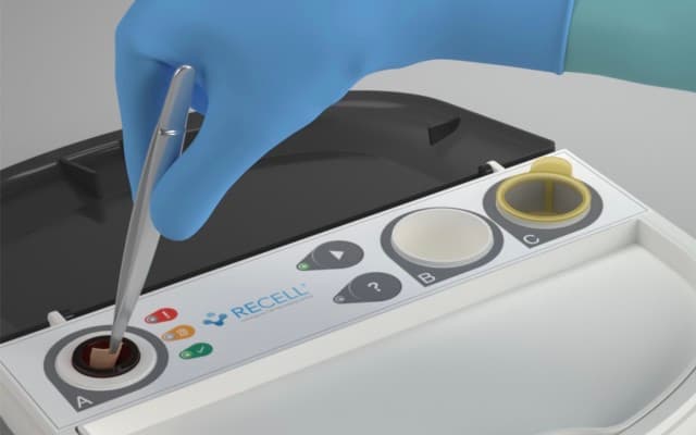 AVITA Medical publishes favourable study results for its RECELL System
