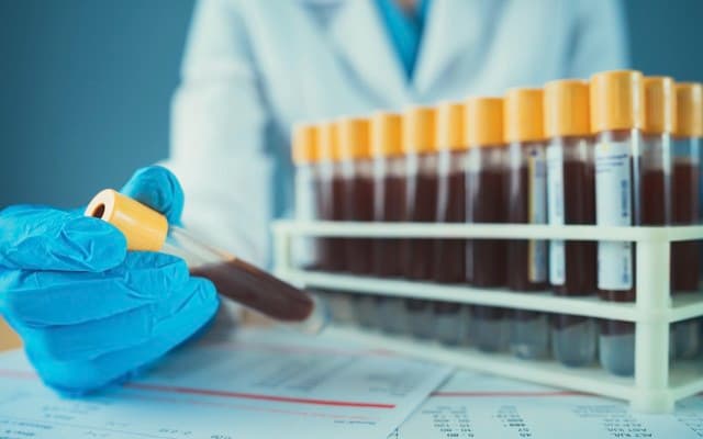 Biotron presents further phase 2 trial results for HIV drug BIT225