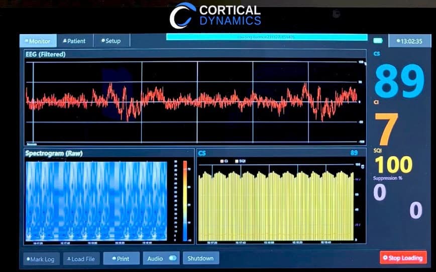 BPH Energy-backed Cortical Dynamics unveils AI-driven neurotechnology innovations