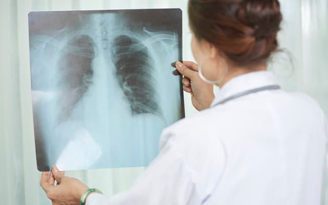 Coronavirus prompts more orders for Micro-X’s mobile x-ray units