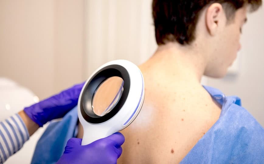 Invion commences dosing in INV043 trial to treat non-melanoma skin cancer