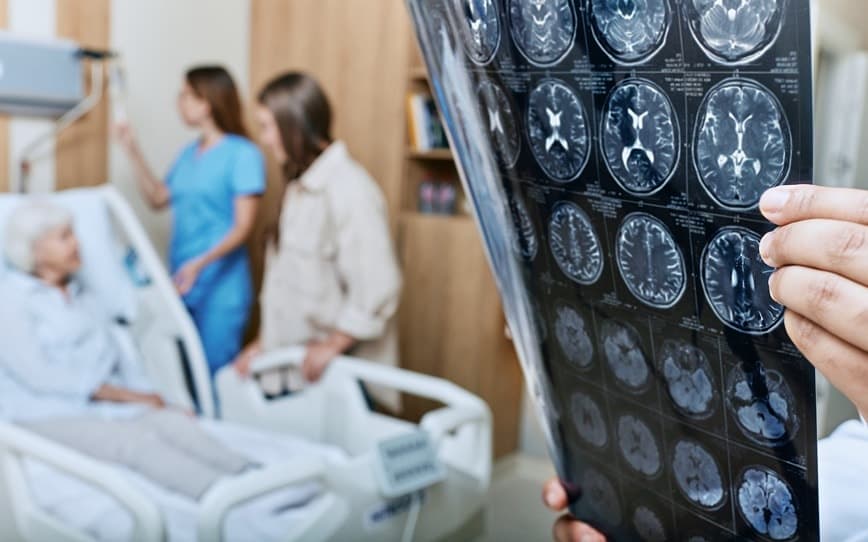 Nyrada NYR-BI03 trial success heralds breakthrough in stroke and brain injury treatment