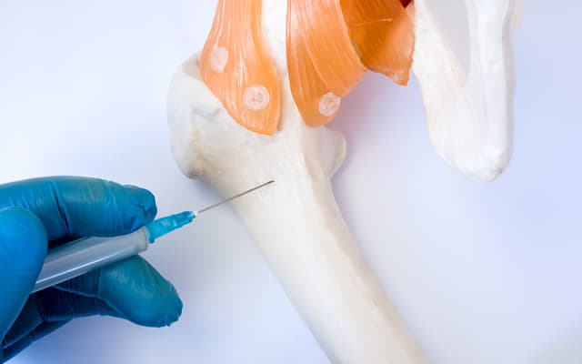 Phase 2 bone marrow transplant drug trial on the horizon for Cynata Therapeutics