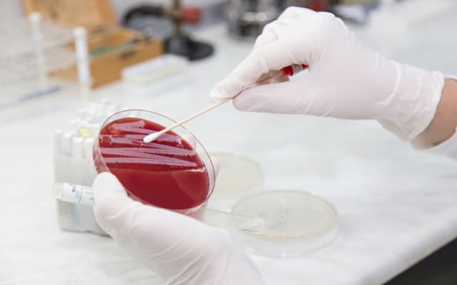 Recce Pharmaceuticals locks-in US patent for synthetic antibiotic to target growing superbug problem