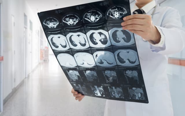 Resonance Health’s FerriSmart MRI iron detection technology to be marketed in US