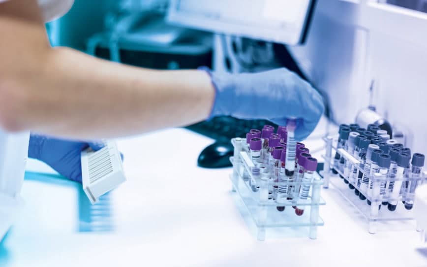 Rhythm Biosciences’ 2G ColoSTAT colorectal cancer detection kit outperforms predecessor in key testing